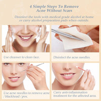 Thumbnail for Blackhead and Acne Removal Kit